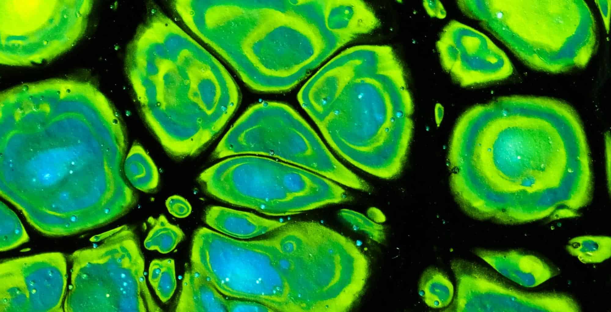 Vibrant abstract painting featuring bright green, blue, and black swirling shapes and splashes.