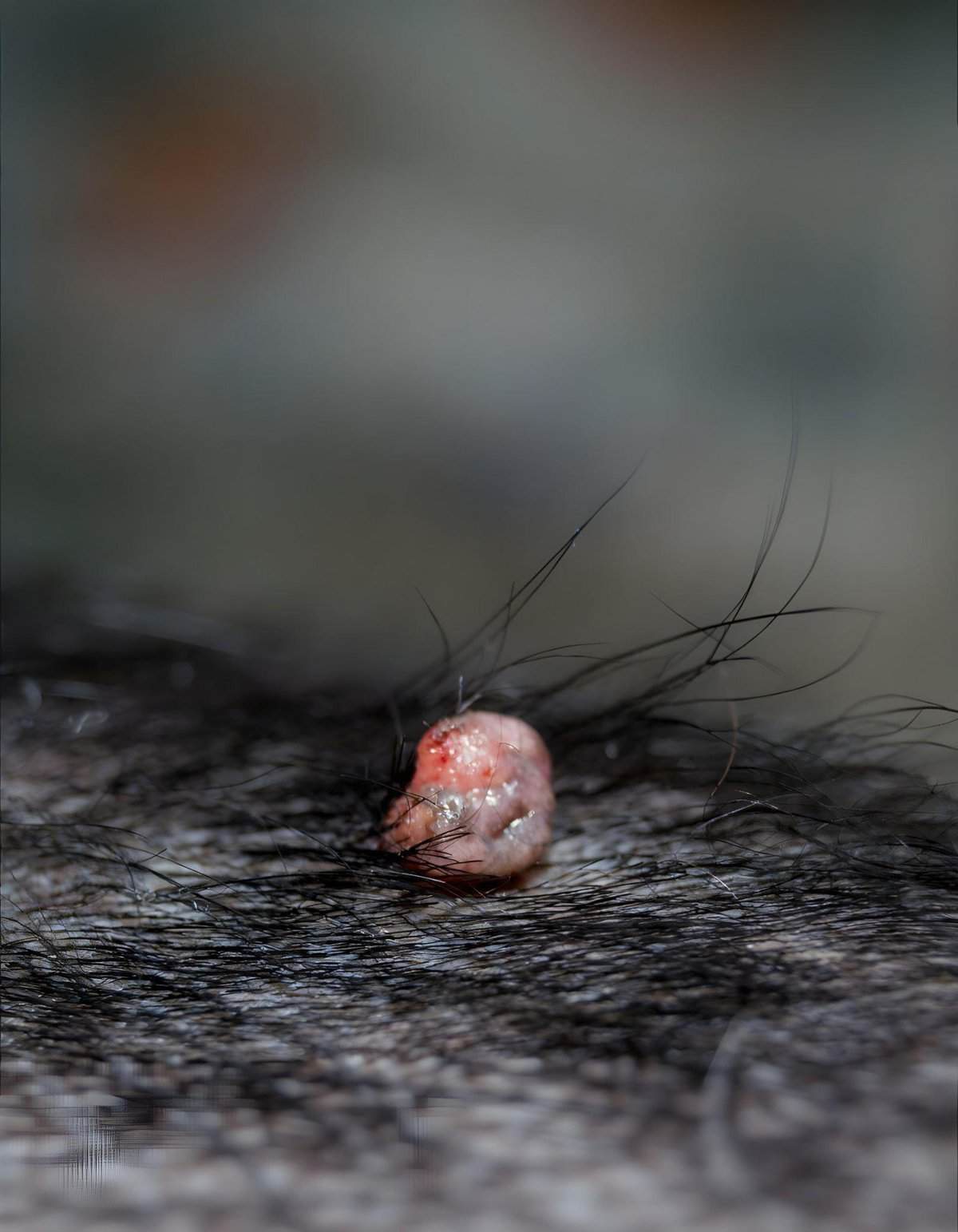 ALT text: Close-up of a mole on human skin with hair around it.