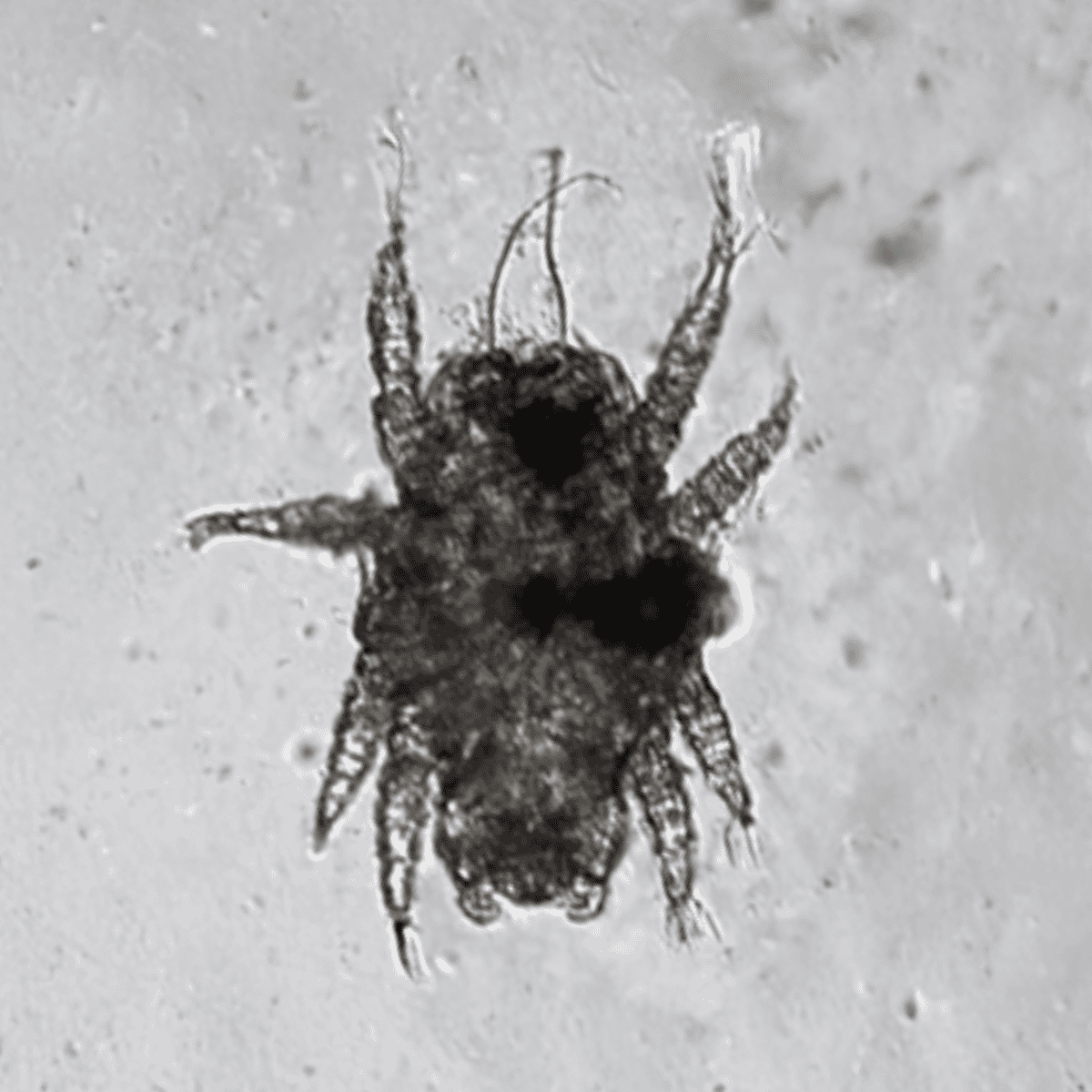 Close-up of a flea on a pet's skin, showing its distinctive small body and legs.