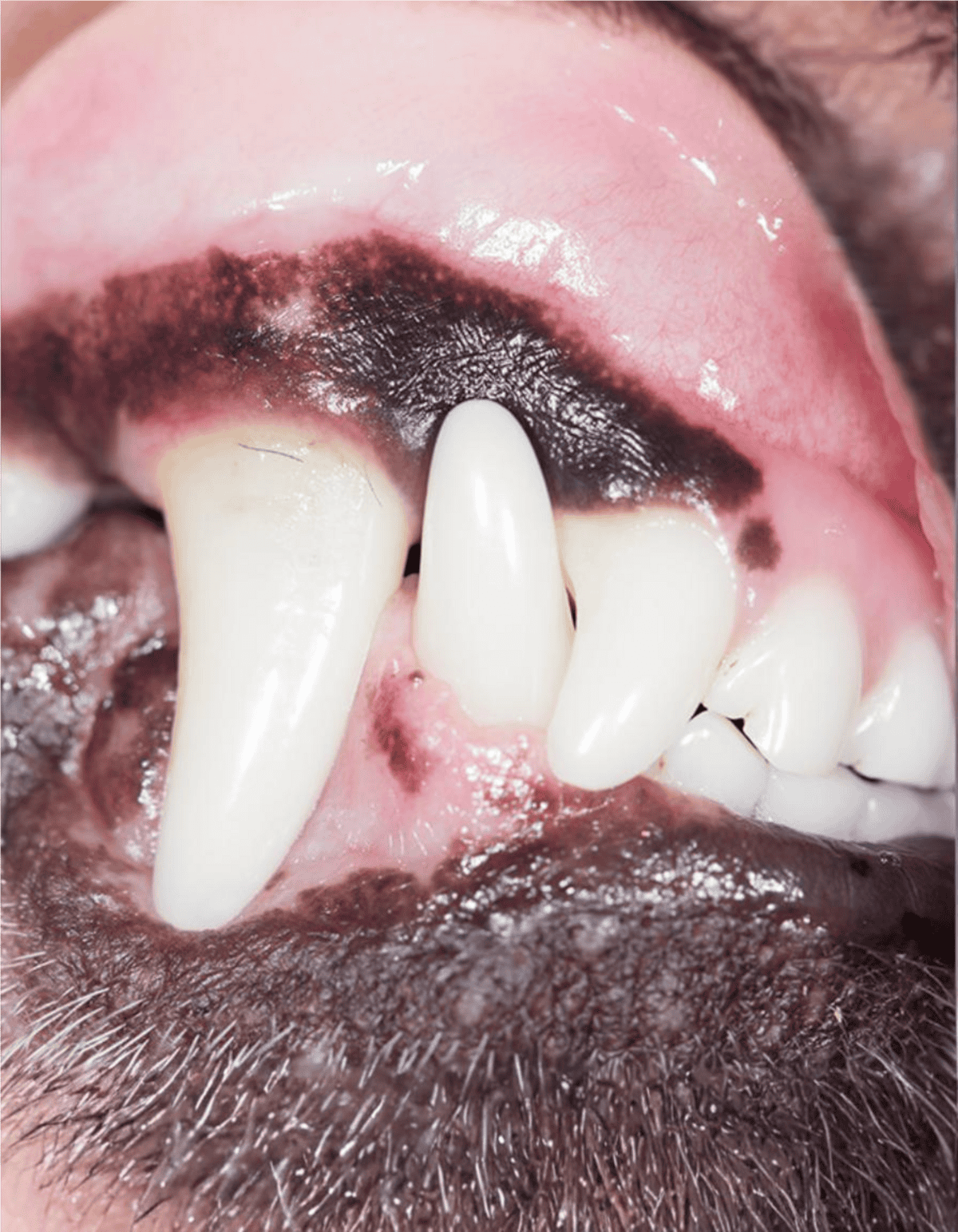 Dog dental health with stained teeth and tartar buildup.