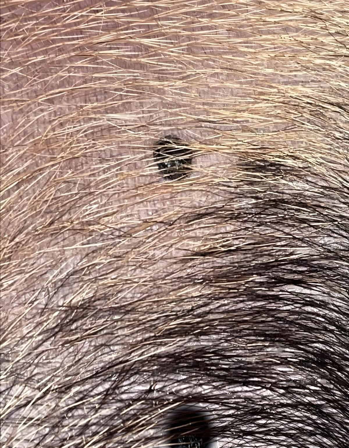 Close-up photo of human scalp showing hair follicles, scalp details, hair texture, and natural hair color variations.