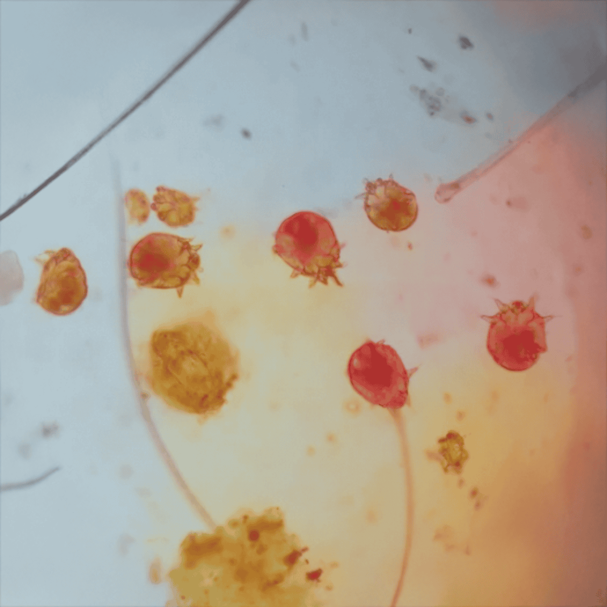 Close-up image of hookworm and roundworm eggs in dog stool sample.